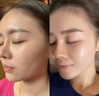 脫毛儀器多功能美容儀opt冰點(diǎn)無(wú)痛嫩膚脫毛機(jī)無(wú)創(chuàng)洗眉洗紋身儀器 810【單手柄-6靶條】(標(biāo)配版) 曬單實(shí)拍圖
