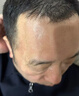 碧素堂（BISUTANG）抬頭紋去除男額頭眉間川字紋貼法令紋消除神器提拉緊致皺紋女專用 50片【鞏固裝】抗皺淡紋【10盒】 曬單實拍圖