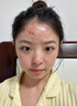 維特絲祛痘藥膏50g壬二酸水楊酸去痘痘和收毛孔閉口粉刺男女精華 曬單實拍圖