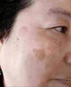 巖井昃弘老年斑專用膏藥貼一夜消手部臉部手背祛斑霜去老人斑除的強力黃褐 一盒（100%發(fā)貨特效快） 曬單實拍圖