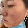 本桑制藥去斑去黑色素去雀斑老年黃褐斑曬斑黑色素沉淀去除男女士專用 3盒周期裝【只要2盒價(jià)格】 曬單實(shí)拍圖