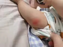 冭川制藥蚊蟲叮咬止癢消腫嬰兒寶寶兒童成人清涼便攜舒緩滾珠全家適用 曬單實(shí)拍圖