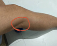 日本腘窩囊腫專用膏藥貼膝蓋后窩疼腫脹滑膜積液腿窩筋痛專用膏藥 一盒裝(100%發(fā)貨特效快) 腘窩型 曬單實拍圖