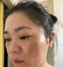 同仁堂美白淡斑霜去斑去黑色素去雀斑黃褐斑曬斑男女士專用醫(yī)用正品中藥 1瓶【3天去各種頑固斑】 曬單實(shí)拍圖
