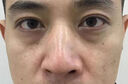 玖美堂眼袋去除神器男士專(zhuān)用眼霜膜眼袋提拉緊致抗皺淡化黑眼圈淡化細(xì)紋 類(lèi)蛇毒眼霜【單盒體驗(yàn)裝】 曬單實(shí)拍圖
