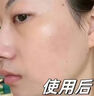 SKISGEM德國進口洗面奶氨基酸控油祛痘去黑頭收縮毛孔男女生日禮物 曬單實拍圖