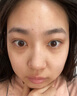 儒意（RUYI）水楊酸面膜20片祛痘淡痘印果酸控油清潔收縮毛孔女男士補水青少年 曬單實拍圖