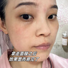 美顏坊曬后修復(fù)面膜舒緩泛紅敏感肌醫(yī)美用防曬傷急救白修護屏障受損15片 曬單實拍圖