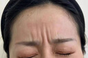 碧素堂（BISUTANG）抬頭紋去除男額頭眉間川字紋貼法令紋消除神器提拉緊致皺紋女專用 150【超值裝】僅1.5/片【30盒】 曬單實拍圖