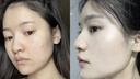 OHBT祛痘膏60g青春痘閉孔粉刺收縮毛孔專用學(xué)生男女凝膠男士化妝品 曬單實(shí)拍圖