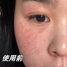 BEAIB5積雪草面膜補水保濕曬后修復(fù)敏感去黃提亮抗皺熬夜急救男女士 曬單實拍圖