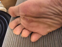 霍樸堂 霍樸樸堂真菌王皮膚瘙癢蘚手足真菌感染私處抑菌大腿內(nèi)側(cè)肛門腳氣男女通用 2瓶【買1瓶送1瓶】 曬單實拍圖