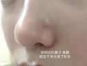 洽苒日本潔面儀洗臉儀去粉刺毛孔清潔可視吸黑頭神器美容儀器家用臉部導出儀面部吸出器 【全配充電綠】贈導出3件套+3個(gè)吸頭 曬單實(shí)拍圖