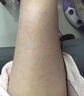 雞皮膚毛囊角化癥去雞皮疙瘩軟化毛囊胳膊腿上有小顆粒毛囊炎有黑點(diǎn)堵塞毛孔皮膚疙疙瘩瘩干燥粗糙保濕乳膏Y 單盒裝【正品】 曬單實(shí)拍圖