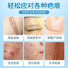 北京同仁堂醫(yī)用硅酮祛疤痕修復(fù)凝膠剖腹產(chǎn)傷疤痕增生凸起疙瘩專用去除疤痕膏 大人兒童刀傷摔傷燙傷疤醫(yī)用硅酮疤痕凝膠20g*5支 醫(yī)院同款 曬單實(shí)拍圖