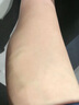 葆元醫(yī)生靜脈曲張冷敷凝膠紅血絲腿部青筋凸起蚯蚓腿腫脹藥膏 3盒裝【性價比高 80%用戶選擇】大多情況都適用 曬單實拍圖