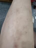 北京協(xié)和醫(yī)學(xué)院止癢膏止癢抑菌皮膚瘙癢身體癢止癢特效濕炎皮疹真菌感染過敏藥膏 1盒【皮膚瘙癢止癢去濕毒】藥膏 香港真菌王百草止癢王去根濕毒清 曬單實(shí)拍圖