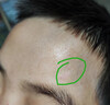 Hirudoid泰國喜遼妥疤痕膏 燙傷痘印凹疤增生修復(fù) 刀疤雙眼皮妊娠紋剖腹產(chǎn) 泰國原裝 40g 1盒 曬單實(shí)拍圖