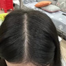 ?硫磺洗發(fā)水兒童專(zhuān)用頭癢剪發(fā)蟲(chóng)脂溢性皮炎抑制馬色拉頭屑止癢控油硫磺軟膏毛囊炎頭皮痘痘硫磺洗發(fā)膏 單瓶裝【專(zhuān)注頭皮護理】 曬單實(shí)拍圖