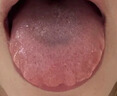 脾胃虛弱濕氣重肝火盛氣血不足 調(diào)理脾胃的中成藥脾胃虛弱中藥調(diào)理去濕氣調(diào)理脾胃參苓健脾胃顆粒脾胃調(diào)理 1盒裝【補(bǔ)脾健胃】5天用量 曬單實(shí)拍圖