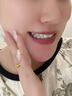 BEEMAG美牙儀冷光亮白牙齒美白儀潔牙器藍(lán)光清潔洗牙去黃牙祛茶漬咖啡漬無線便攜神儀器送男女朋友禮物 冷光無線美牙儀【6支凝膠+比色卡】 曬單實(shí)拍圖