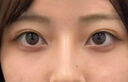歐誘去眼袋消除重度眼袋專用霜去除神器祛大眼袋嚴重中老年男女士貼膜 1盒裝【魚子醬修護眼霜】 提拉緊致抗皺淡化細紋 曬單實拍圖