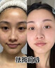 焦博士日本377祛斑霜美白淡化老年黃褐雀斑黑色素熊果苷乳膏去曬男女士 曬單實(shí)拍圖
