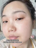 臻羞壬二酸15%凝膠和水楊酸細(xì)致毛孔霜凝露可搭痘肌黑頭閉口粉刺軟膏 15%壬二酸100g+水楊酸霜100g 曬單實拍圖
