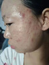 當(dāng)歸苦參丸北京同仁堂祛痘消炎痤瘡專用青少年臉上長痘痘吃什么口服內(nèi)調(diào)治粉刺痤瘡硬疙瘩青春痘去痘的內(nèi)服藥 1盒裝【治粉刺閉口痤瘡的中成藥】 曬單實拍圖