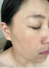 片仔癀皇后牌美白祛斑膏美白淡化黑色素老年黃褐雀斑曬斑祛斑霜護膚品女 美白祛斑膏1瓶【贈防曬霜】 曬單實拍圖