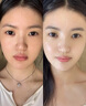 透真美白淡斑精華液377提亮去黃改善暗沉膚色曬后修復(fù)泛紅577祛斑次拋 曬單實(shí)拍圖