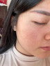 南京同仁堂祛痘膏去痘痘和痘印痘坑修復(fù)男女士改善粉刺閉口30g 曬單實拍圖