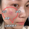 奈皙日本曬后修復(fù)面膜急救敏感泛紅女男士夏季神經(jīng)酰胺改善醫(yī)美用煥白 曬單實(shí)拍圖