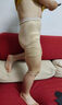 醫樂(lè )聚定制醫用加壓彈力褲膝蓋大腿小腿燒燙傷抑制疤痕增生彈力衣壓力套 加壓中褲 量身定制（不退不換-可修改） 曬單實(shí)拍圖
