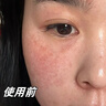 美顏坊曬后修復(fù)面膜舒緩泛紅敏感肌醫(yī)美用防曬傷急救白修護屏障受損15片 曬單實拍圖