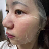 焦博士日本曬后修復(fù)面膜修復(fù)敏感皮膚屏障受損泛紅醫(yī)美用防曬傷急救白 曬單實(shí)拍圖