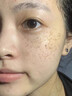 南京同仁堂祛斑霜美白去雀斑黃褐斑曬斑妊娠斑淡化黑色素男女士補(bǔ)水保濕面霜 3瓶輕度斑 【立省40】 曬單實(shí)拍圖