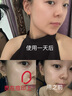 華美科氨甲環(huán)酸乳膏軟膏祛斑霜美白淡化黑色素美白淡斑霜淡化黑色素1支 曬單實(shí)拍圖