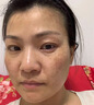 郝愛妮美白祛斑霜淡化黑色素去雀斑黃褐斑祛斑美白提亮去黃改善暗沉膚色 曬單實拍圖