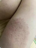 同仁堂醫(yī)用皮炎濕疹噴霧劑濕性液體敷料皮膚痤瘡干燥紅斑瘙癢外用官方 1瓶*30ml[體驗(yàn)裝] 曬單實(shí)拍圖