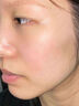 維特絲祛痘藥膏50g壬二酸水楊酸去痘痘和收毛孔閉口粉刺男女精華 曬單實(shí)拍圖