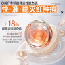 OHBT膠態(tài)硫控油祛痘精華液35ml淡化痘印痘坑修復(fù)收縮毛孔祛痘痘護(hù)膚品 曬單實(shí)拍圖