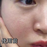 BAJK黑頭導出液鼻子去黑頭粉刺收縮毛孔深層清潔清理神器粗大修復閉口 【黑頭閉口粉刺】黑頭導出液*1瓶 黑頭粉刺丨收縮毛孔丨無效包退 曬單實拍圖