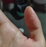 汗皰疹100%特專(zhuān)用效藥濕疹特瘙癢效藥止癢去治根手指上癢起小水泡止癢抑菌膏脫皮真菌感染阿昔洛韋乳膏 1盒【手癢起小水泡止癢專(zhuān)用藥】 曬單實(shí)拍圖