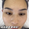 百靈鳥377美白祛斑霜祛斑美白淡化黑色素去雀斑老年黃褐斑男女士專用 曬單實(shí)拍圖