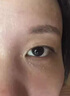 修正脂肪粒汗管瘤去除藥膏神器眼部栗丘疹扁平疣白色顆粒專用眼霜膏藥 單盒裝 曬單實(shí)拍圖