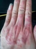 李時(shí)珍苗疆百草膏官方正品皮膚軟膏艾葉透骨草肉桂全身通用直播同款ql 拍一發(fā)一【體驗(yàn)】實(shí)發(fā)1瓶 曬單實(shí)拍圖