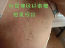 DRVIALY脂肪瘤專用特姣藥脂肪康貼脂肪粒去除藥膏皮下多發(fā)性囊腫硬包塊 3盒療程裝【消脂肪瘤神器特效果】 曬單實(shí)拍圖