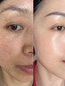 OHBT黃芪面膜10片抗皺緊致抗衰老補(bǔ)水熬夜美白淡斑女男士金榜第1名 曬單實(shí)拍圖