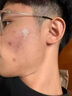 O'KADY東來硫磺洗面奶控油祛痘除螨蟲去黑頭毛孔清潔洗面乳男女士專用 兩瓶裝【清潔黑頭粉刺閉口】 曬單實(shí)拍圖